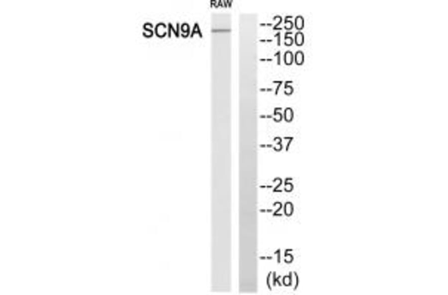 Western blot - SCN9A Antibody from Signalway Antibody (35056) - Antibodies.com