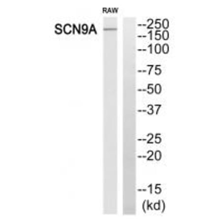 Western blot - SCN9A Antibody from Signalway Antibody (35056) - Antibodies.com