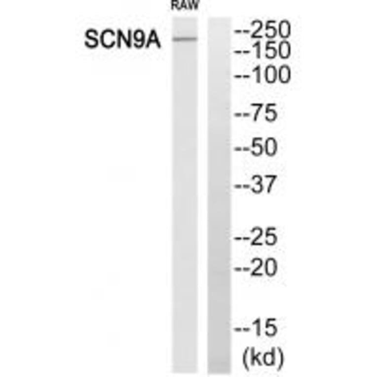 Western blot - SCN9A Antibody from Signalway Antibody (35056) - Antibodies.com