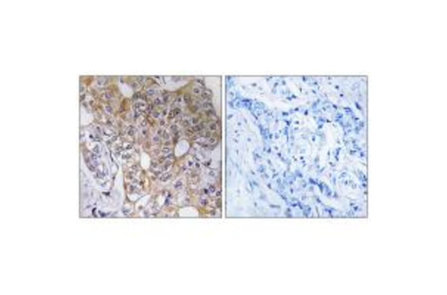 Immunohistochemistry - CCT6A Antibody from Signalway Antibody (35092) - Antibodies.com