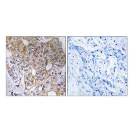 Immunohistochemistry - CCT6A Antibody from Signalway Antibody (35092) - Antibodies.com