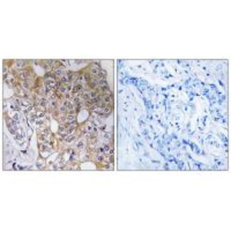 Immunohistochemistry - CCT6A Antibody from Signalway Antibody (35092) - Antibodies.com
