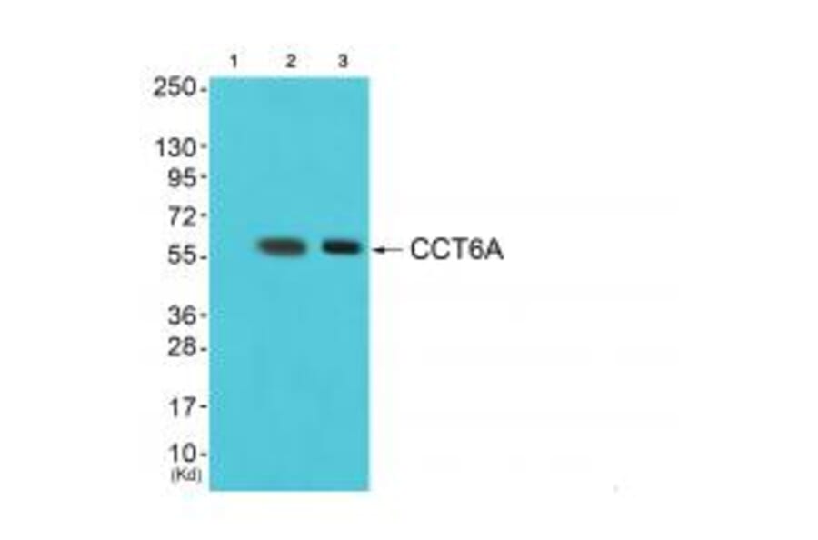 Western blot - CCT6A Antibody from Signalway Antibody (35092) - Antibodies.com