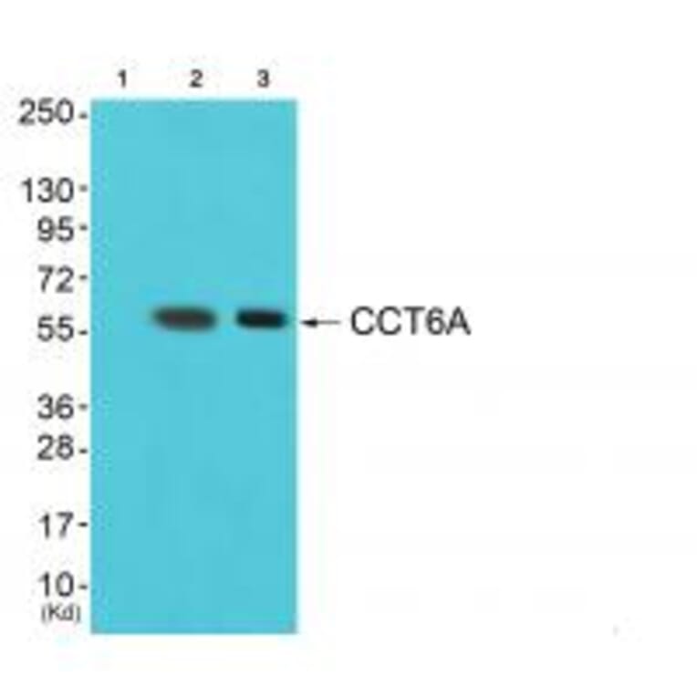 Western blot - CCT6A Antibody from Signalway Antibody (35092) - Antibodies.com