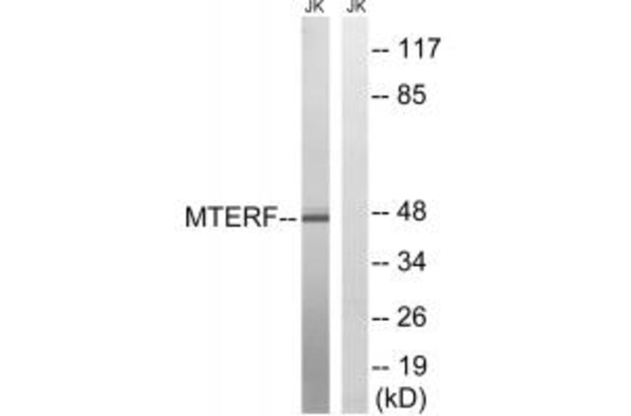 Western blot - MTERF Antibody from Signalway Antibody (35106) - Antibodies.com