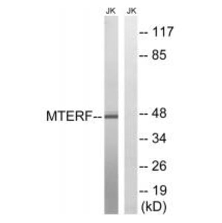 Western blot - MTERF Antibody from Signalway Antibody (35106) - Antibodies.com
