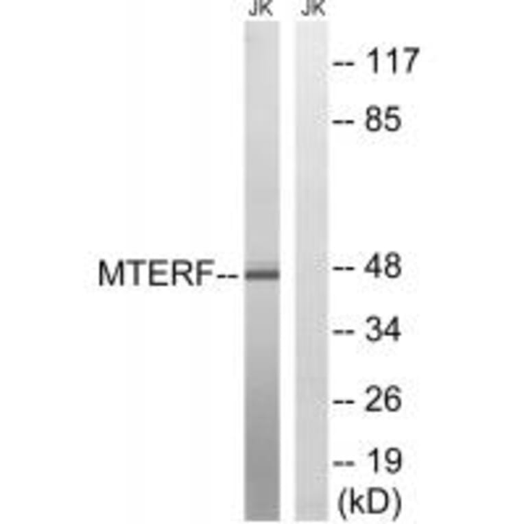 Western blot - MTERF Antibody from Signalway Antibody (35106) - Antibodies.com