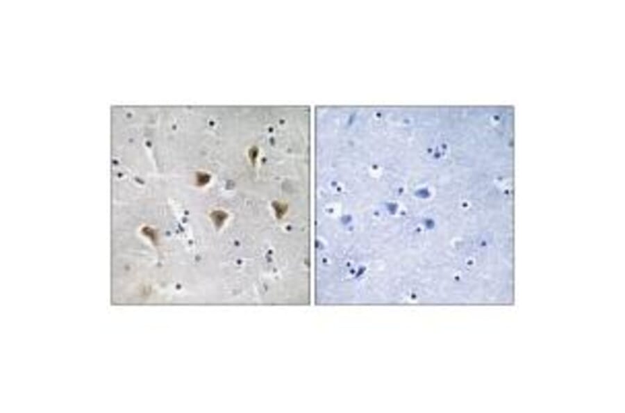 Immunohistochemistry - MTERF Antibody from Signalway Antibody (35106) - Antibodies.com