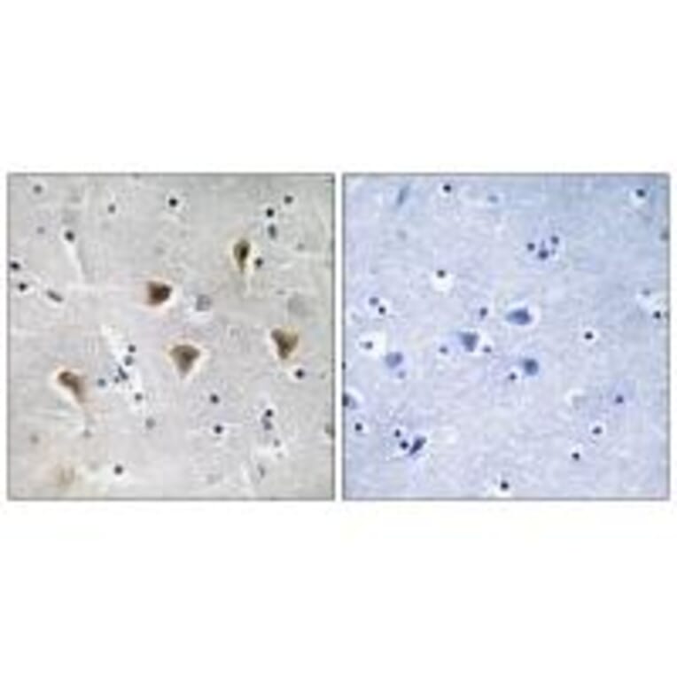 Immunohistochemistry - MTERF Antibody from Signalway Antibody (35106) - Antibodies.com