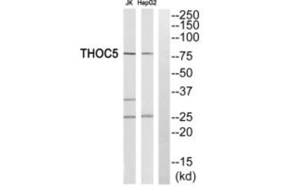 Western blot - THOC5 Antibody from Signalway Antibody (35135) - Antibodies.com