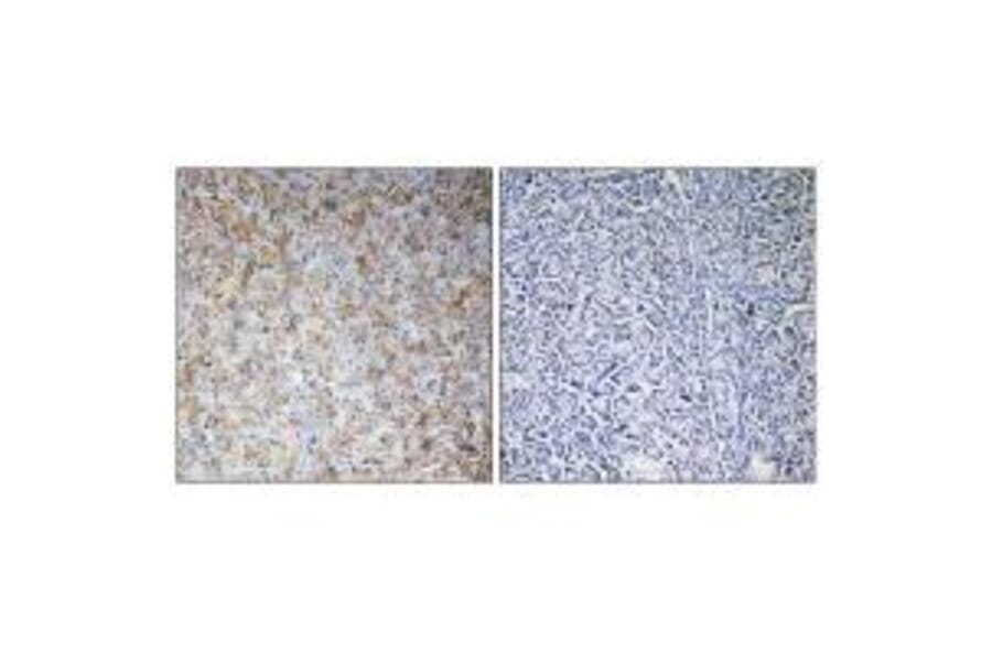 Immunohistochemistry - WASF2 Antibody from Signalway Antibody (35147) - Antibodies.com