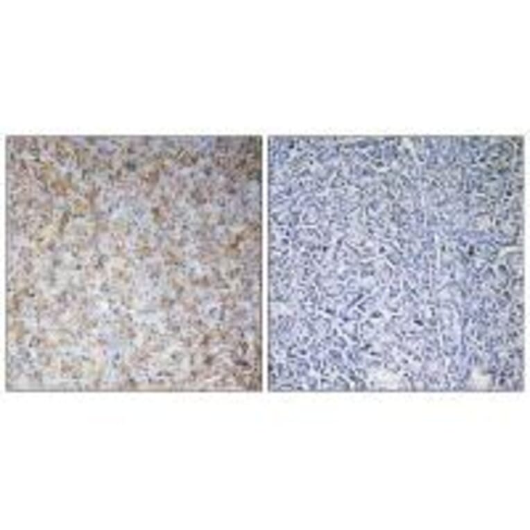Immunohistochemistry - WASF2 Antibody from Signalway Antibody (35147) - Antibodies.com