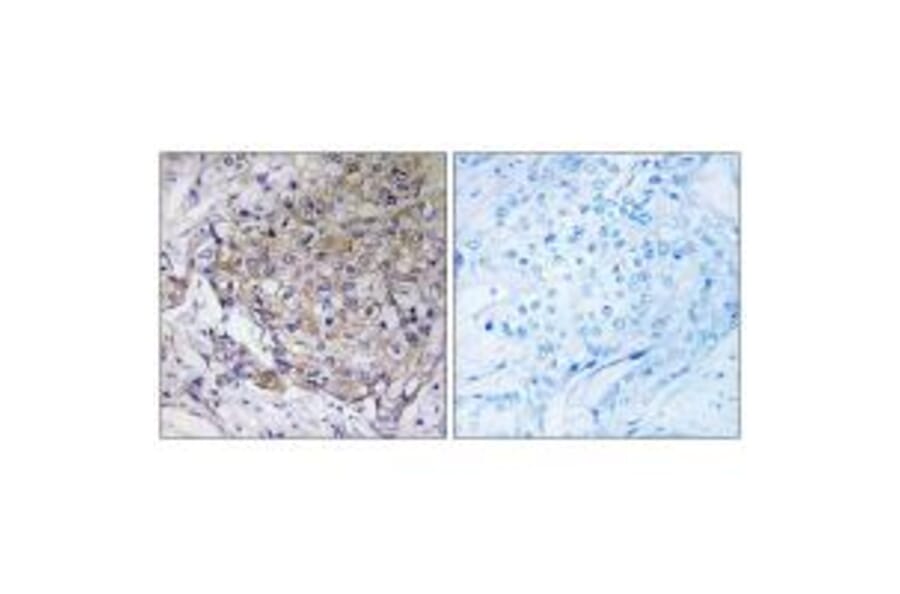 Immunohistochemistry - WASF3 Antibody from Signalway Antibody (35148) - Antibodies.com