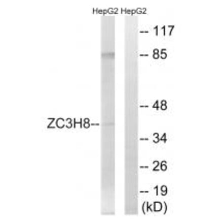 Western blot - ZC3H8 Antibody from Signalway Antibody (35154) - Antibodies.com