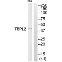 Western blot analysis of extracts from HeLa cells, using TBPL2 antibody #35184.