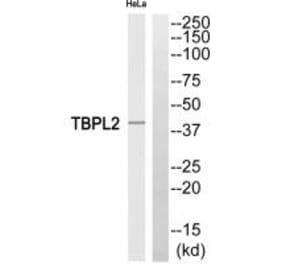 Western blot - TBPL2 Antibody from Signalway Antibody (35184) - Antibodies.com