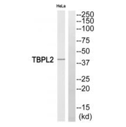Western blot - TBPL2 Antibody from Signalway Antibody (35184) - Antibodies.com