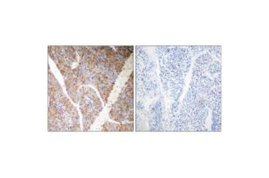 Immunohistochemistry - BAG3 Antibody from Signalway Antibody (35276) - Antibodies.com