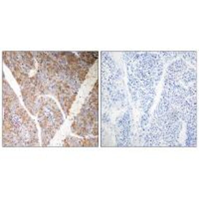Immunohistochemistry - BAG3 Antibody from Signalway Antibody (35276) - Antibodies.com