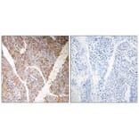 Immunohistochemistry - BAG3 Antibody from Signalway Antibody (35276) - Antibodies.com