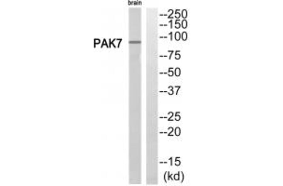 Western blot - PAK7 Antibody from Signalway Antibody (35292) - Antibodies.com