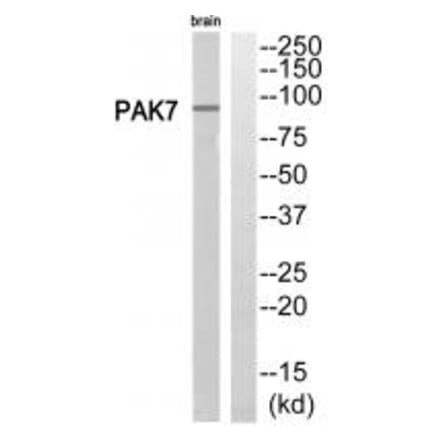 Western blot - PAK7 Antibody from Signalway Antibody (35292) - Antibodies.com