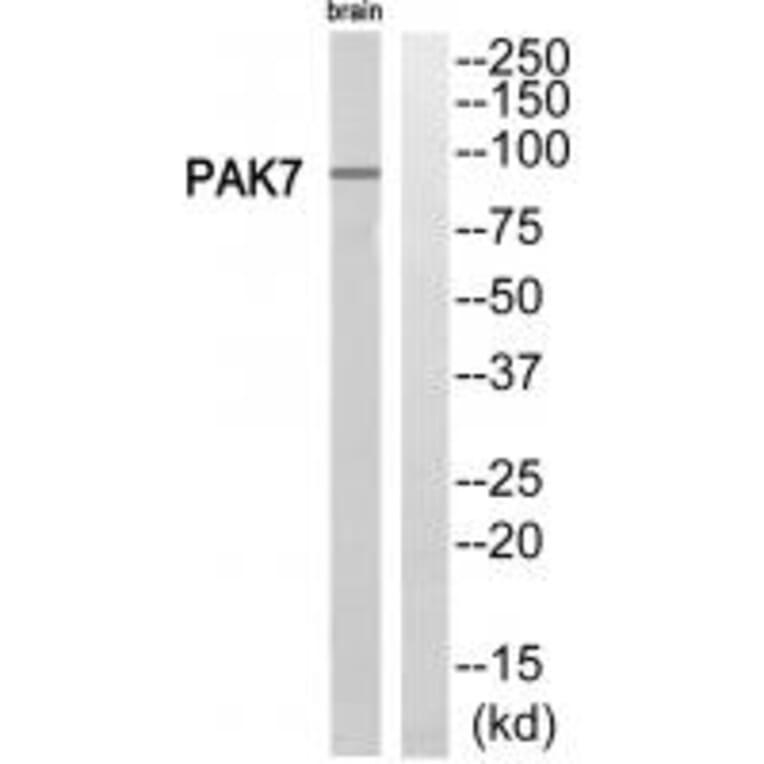 Western blot - PAK7 Antibody from Signalway Antibody (35292) - Antibodies.com