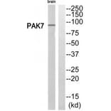 Western blot - PAK7 Antibody from Signalway Antibody (35292) - Antibodies.com