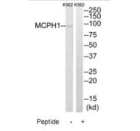 Western blot - MCPH1 Antibody from Signalway Antibody (35323) - Antibodies.com