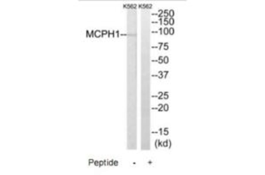 Western blot - MCPH1 Antibody from Signalway Antibody (35323) - Antibodies.com