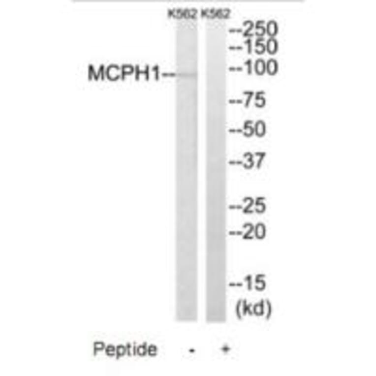 Western blot - MCPH1 Antibody from Signalway Antibody (35323) - Antibodies.com