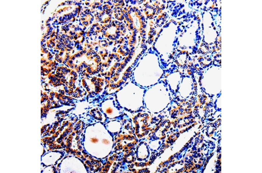 Immunohistochemistry - TUBB3 Antibody from Signalway Antibody (35539) - Antibodies.com