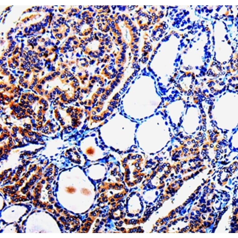 Immunohistochemistry - TUBB3 Antibody from Signalway Antibody (35539) - Antibodies.com