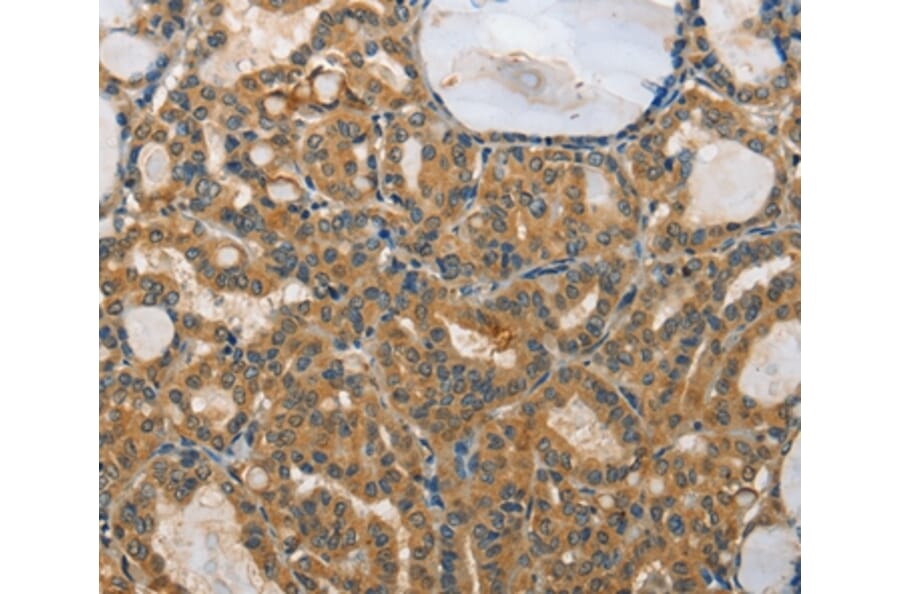 Immunohistochemistry - RPS27 Antibody from Signalway Antibody (35544) - Antibodies.com