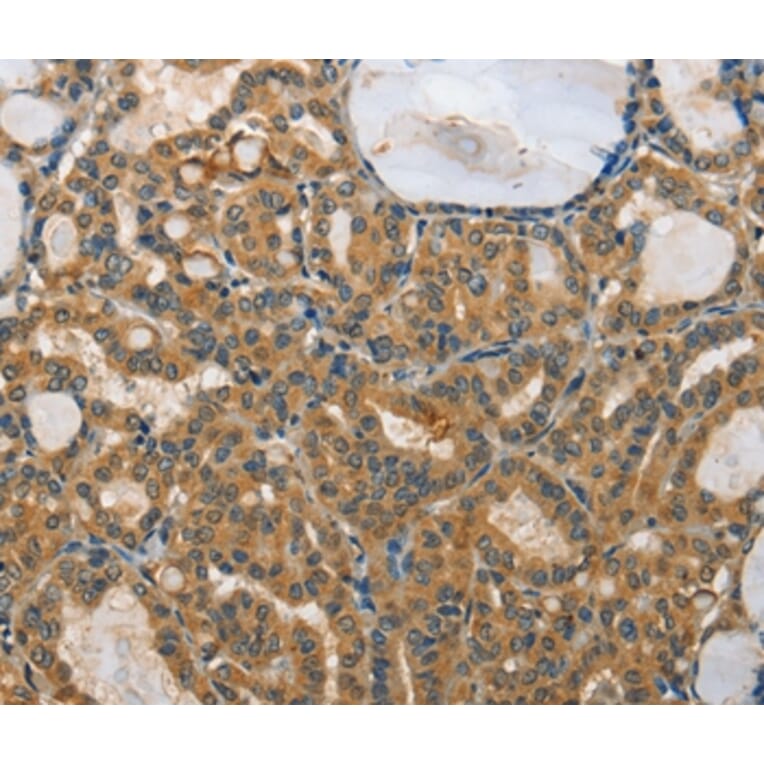 Immunohistochemistry - RPS27 Antibody from Signalway Antibody (35544) - Antibodies.com
