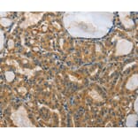 Immunohistochemistry - RPS27 Antibody from Signalway Antibody (35544) - Antibodies.com