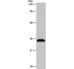 UPK3B Antibody from Signalway Antibody (35546) - Antibodies.com