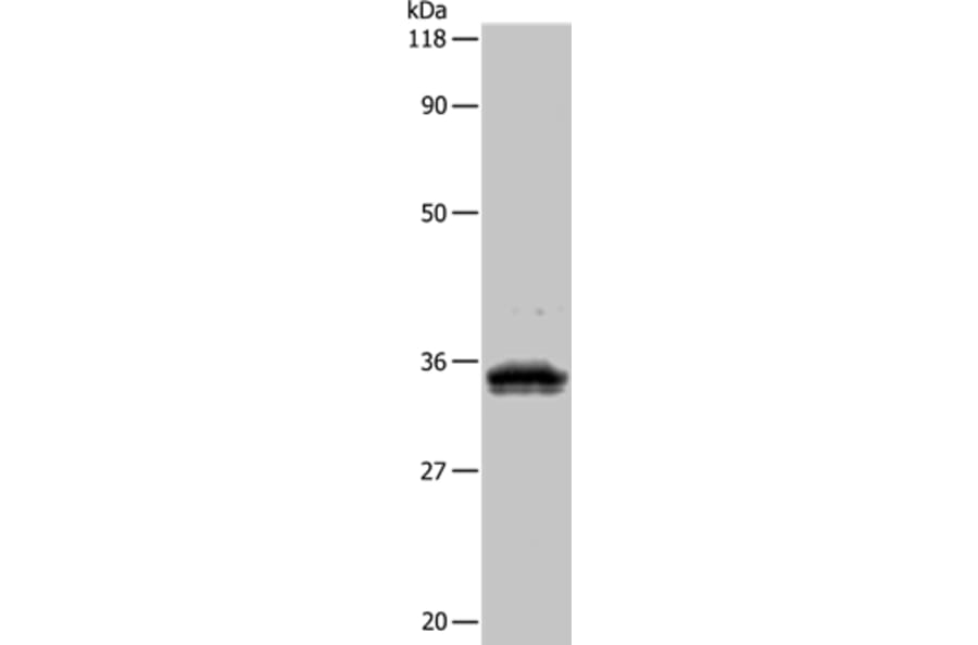 UPK3B Antibody from Signalway Antibody (35546) - Antibodies.com