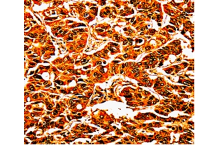 Immunohistochemistry - UPK3B Antibody from Signalway Antibody (35546) - Antibodies.com