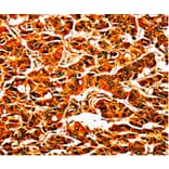 Immunohistochemistry - UPK3B Antibody from Signalway Antibody (35546) - Antibodies.com