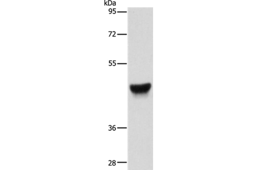 KRT13 Antibody from Signalway Antibody (35558) - Antibodies.com