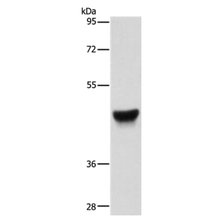 KRT13 Antibody from Signalway Antibody (35558) - Antibodies.com