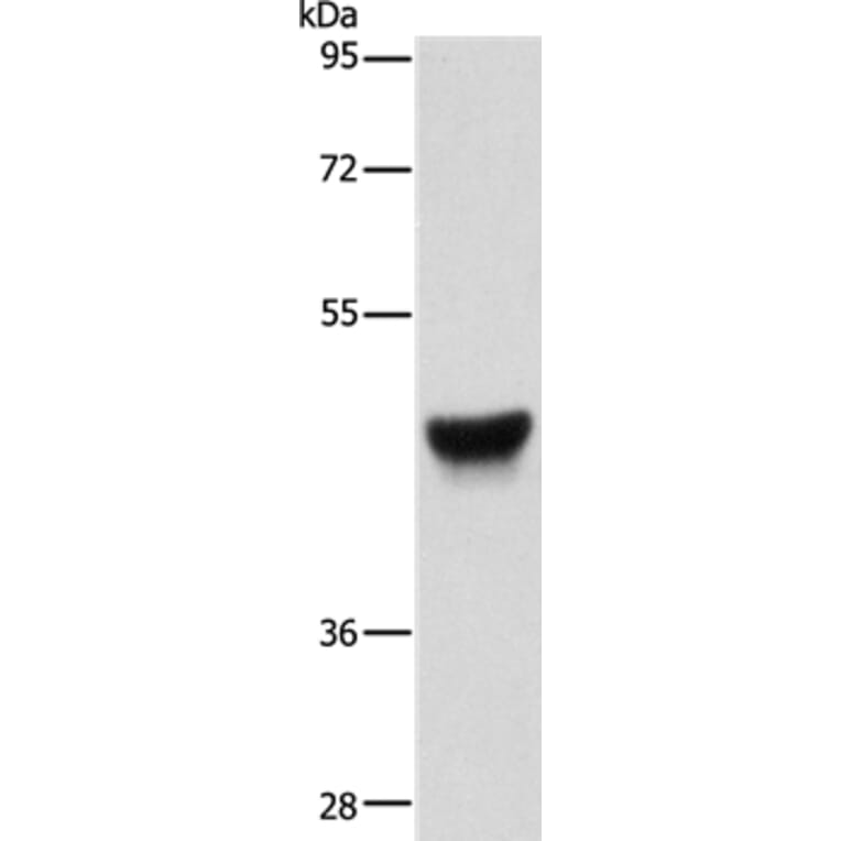 KRT13 Antibody from Signalway Antibody (35558) - Antibodies.com