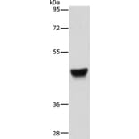 KRT13 Antibody from Signalway Antibody (35558) - Antibodies.com