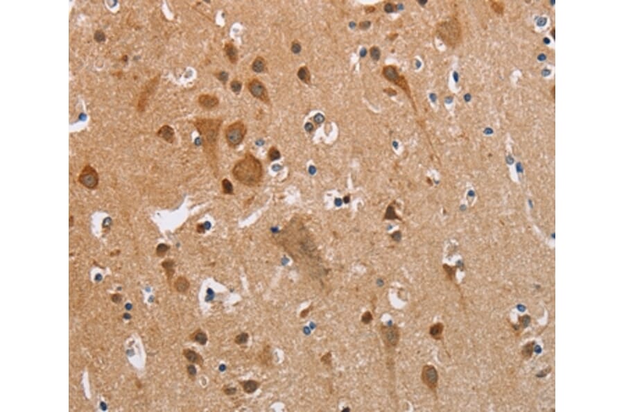 Immunohistochemistry - KRT13 Antibody from Signalway Antibody (35558) - Antibodies.com