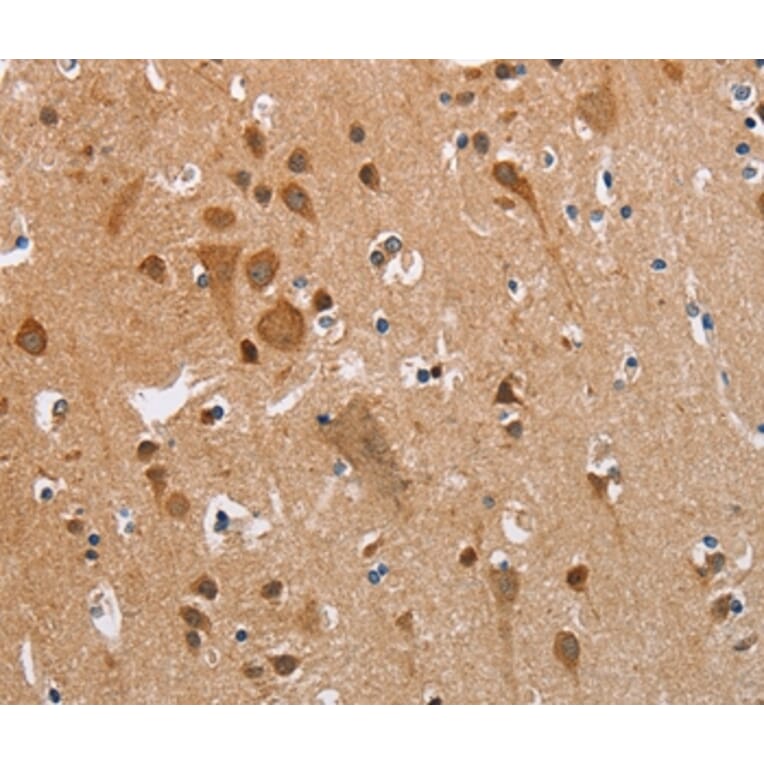 Immunohistochemistry - KRT13 Antibody from Signalway Antibody (35558) - Antibodies.com