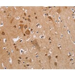 Immunohistochemistry - KRT13 Antibody from Signalway Antibody (35558) - Antibodies.com