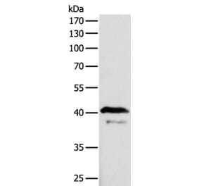 ADAP1 Antibody from Signalway Antibody (35561) - Antibodies.com