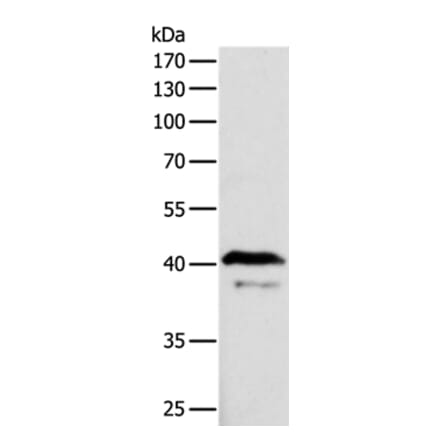 ADAP1 Antibody from Signalway Antibody (35561) - Antibodies.com
