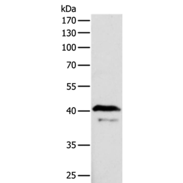 ADAP1 Antibody from Signalway Antibody (35561) - Antibodies.com